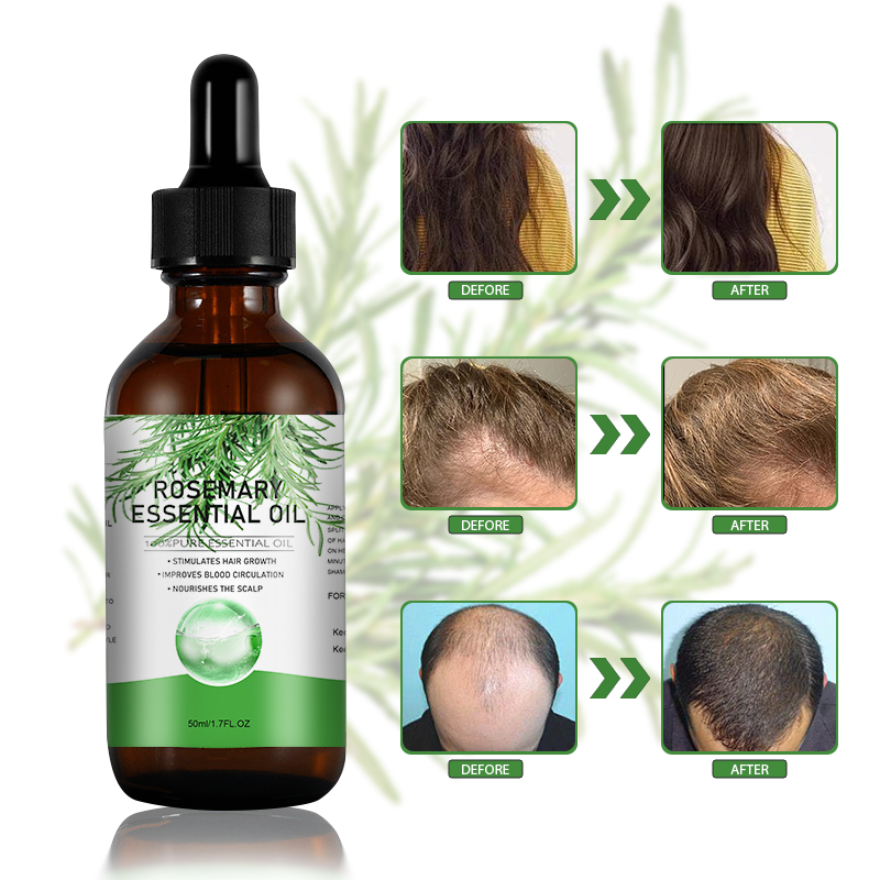 Rosemary Oil – Olio Essenziale di Rosmarino